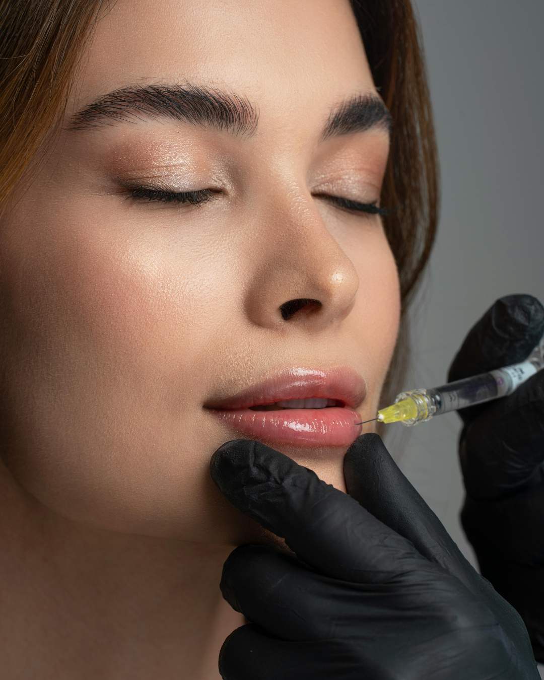 Fillers - What You Can Expect