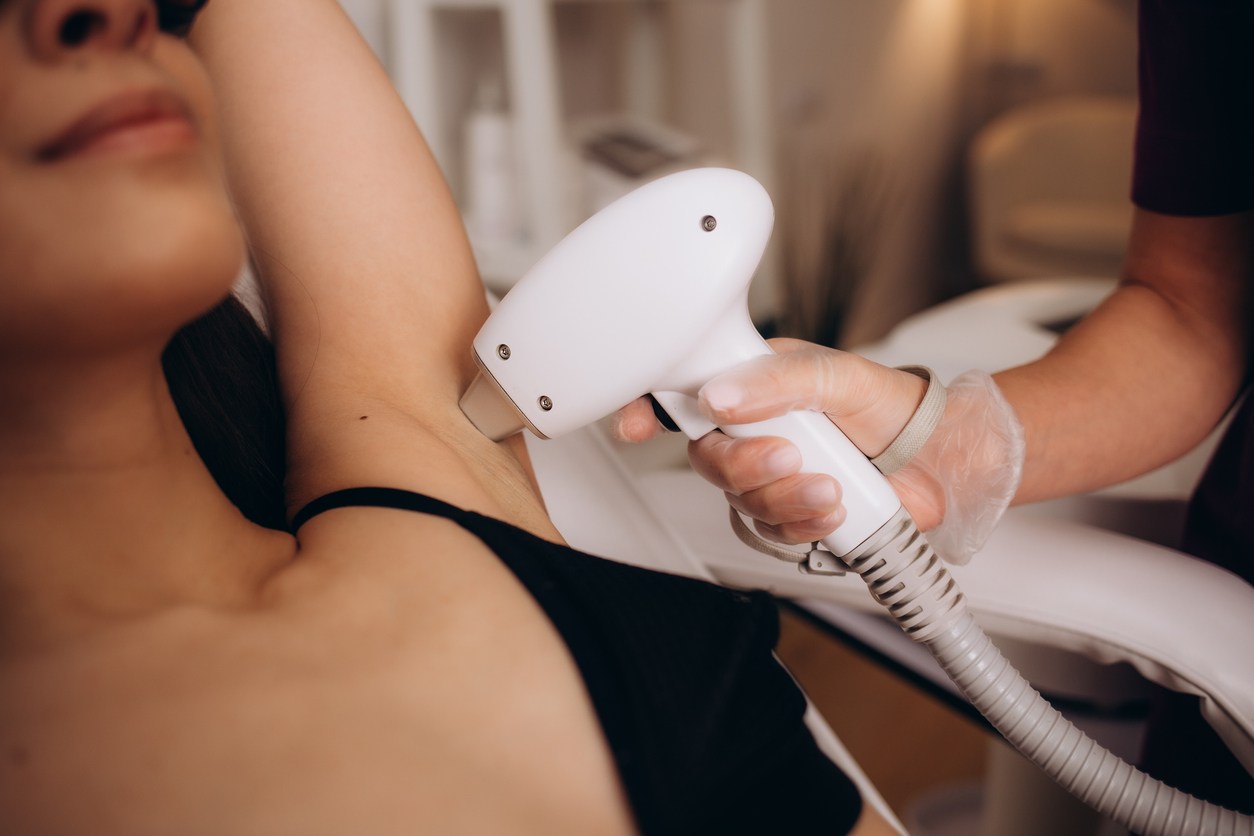 Laser Hair Removal - How Many Sessions Are Needed