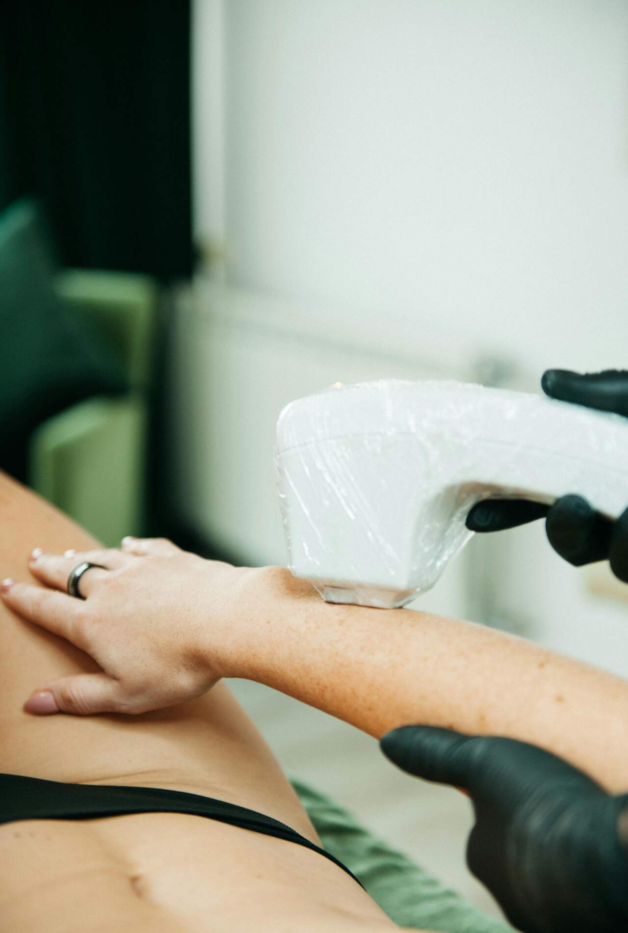 Laser Hair Removal - What to Expect During a Session