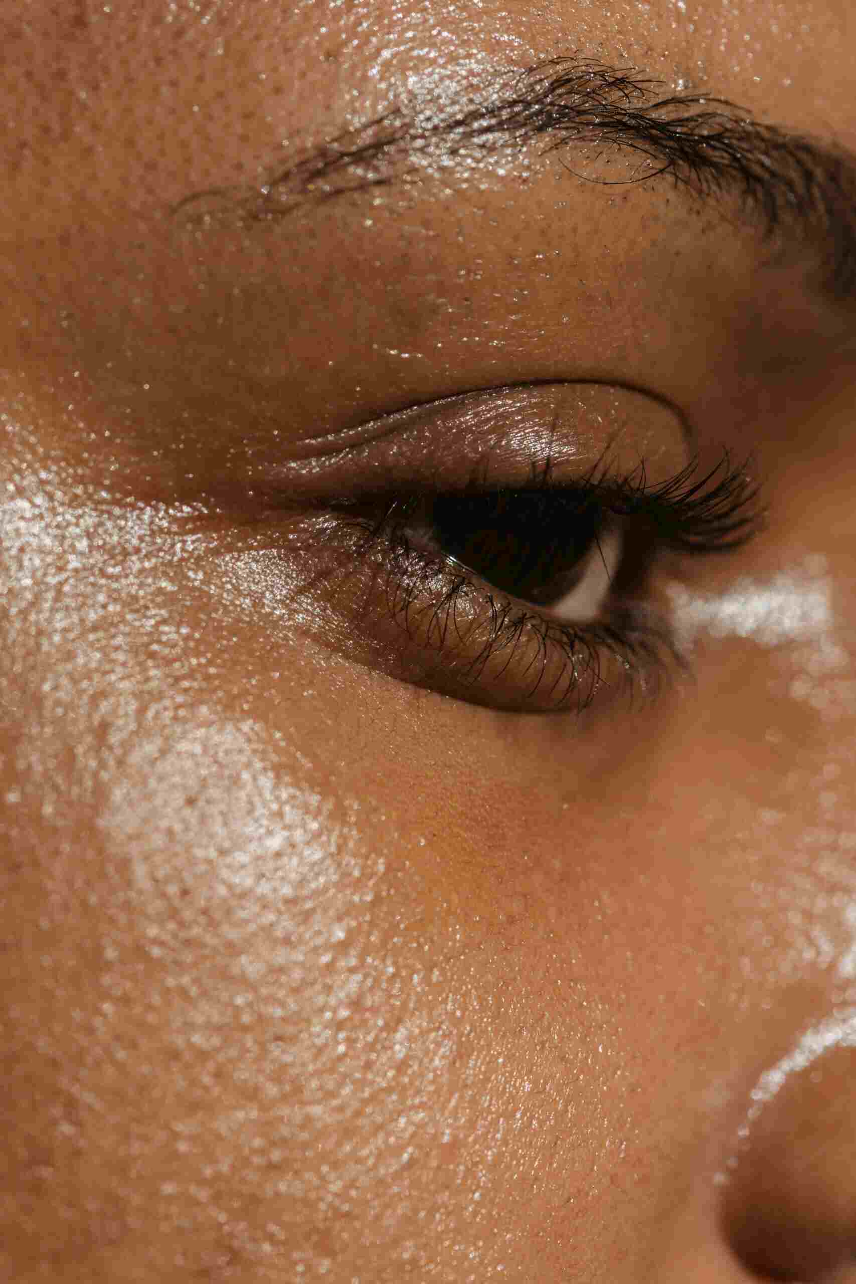 ultraclear treatment NYC