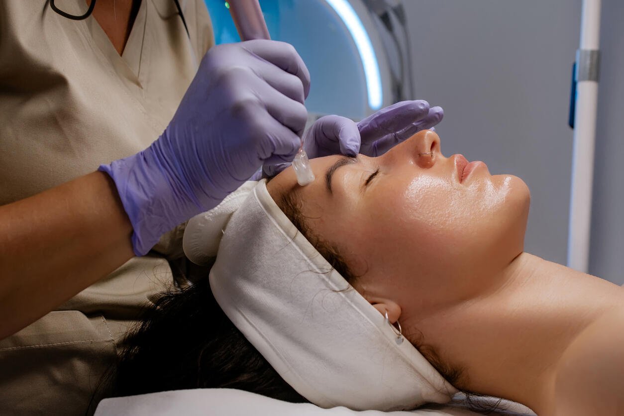 microneedling la reserve