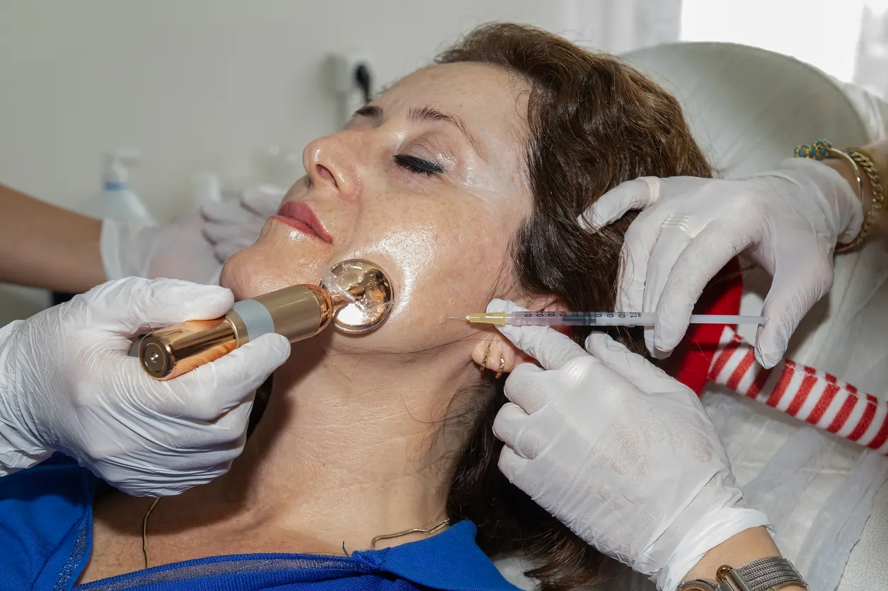 The Benefits of Morpheus8 Treatment