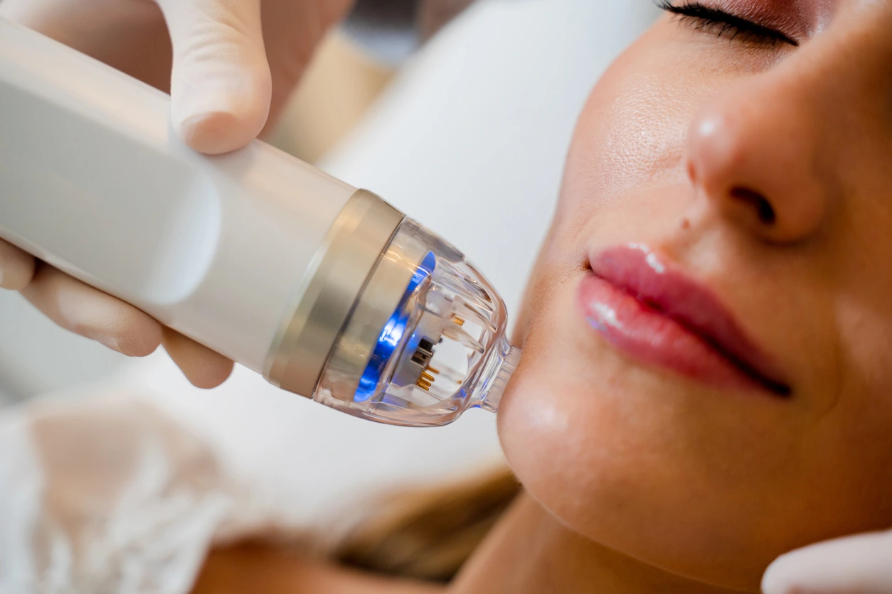 skin remodeling treatment face